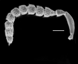 Anidarnes_bicolor_antenna
